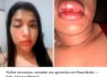 Vereador é denunciado por agressão contra namorada no Bico do Papagaio