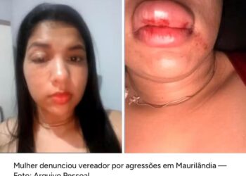 Vereador é denunciado por agressão contra namorada no Bico do Papagaio