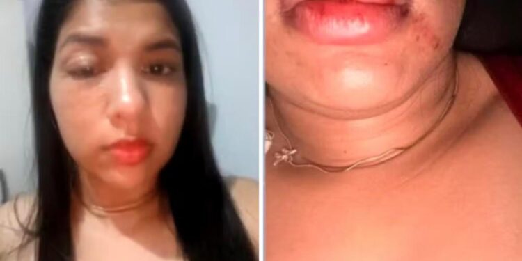 Vereador é denunciado por agressão contra namorada no Bico do Papagaio