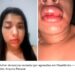 Vereador é denunciado por agressão contra namorada no Bico do Papagaio